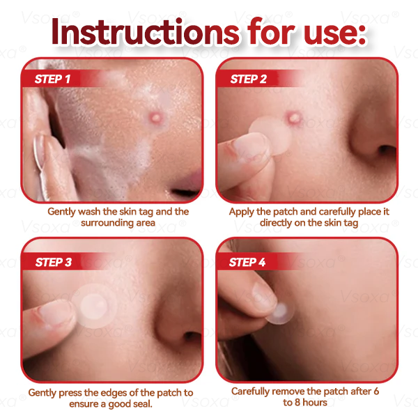 CZTICLEยฎ ๐งMicroneedles Botanical Skin Tags Solution Patches - Made in the USA๐ฉโโ๏ธ