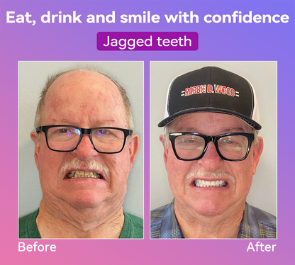 𝐉𝐚𝐬𝐬𝐞𝐞𝐦®🍎𝐍𝐞𝐱𝐭-𝐆𝐞𝐧 𝐂𝐨𝐦𝐟𝐨𝐫𝐭 𝐃𝐞𝐧𝐭𝐮𝐫𝐞(🦷𝐋𝐢𝐦𝐢𝐭𝐞𝐝 𝐭𝐢𝐦𝐞 𝐝𝐢𝐬𝐜𝐨𝐮𝐧𝐭 𝐋𝐚𝐬𝐭 𝟑𝟎 𝐦𝐢𝐧𝐮𝐭𝐞𝐬🦷)