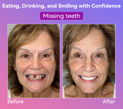 𝐉𝐚𝐬𝐬𝐞𝐞𝐦®🍎𝐍𝐞𝐱𝐭-𝐆𝐞𝐧 𝐂𝐨𝐦𝐟𝐨𝐫𝐭 𝐃𝐞𝐧𝐭𝐮𝐫𝐞(🦷𝐋𝐢𝐦𝐢𝐭𝐞𝐝 𝐭𝐢𝐦𝐞 𝐝𝐢𝐬𝐜𝐨𝐮𝐧𝐭 𝐋𝐚𝐬𝐭 𝟑𝟎 𝐦𝐢𝐧𝐮𝐭𝐞𝐬🦷)