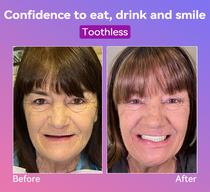 𝐉𝐚𝐬𝐬𝐞𝐞𝐦®🍎𝐍𝐞𝐱𝐭-𝐆𝐞𝐧 𝐂𝐨𝐦𝐟𝐨𝐫𝐭 𝐃𝐞𝐧𝐭𝐮𝐫𝐞(🦷𝐋𝐢𝐦𝐢𝐭𝐞𝐝 𝐭𝐢𝐦𝐞 𝐝𝐢𝐬𝐜𝐨𝐮𝐧𝐭 𝐋𝐚𝐬𝐭 𝟑𝟎 𝐦𝐢𝐧𝐮𝐭𝐞𝐬🦷)