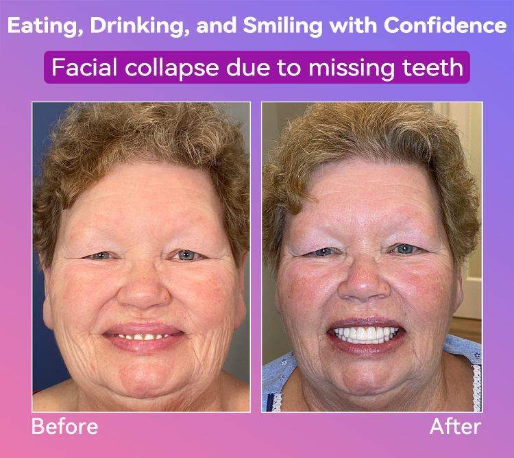 𝐉𝐚𝐬𝐬𝐞𝐞𝐦®🍎𝐍𝐞𝐱𝐭-𝐆𝐞𝐧 𝐂𝐨𝐦𝐟𝐨𝐫𝐭 𝐃𝐞𝐧𝐭𝐮𝐫𝐞(🦷𝐋𝐢𝐦𝐢𝐭𝐞𝐝 𝐭𝐢𝐦𝐞 𝐝𝐢𝐬𝐜𝐨𝐮𝐧𝐭 𝐋𝐚𝐬𝐭 𝟑𝟎 𝐦𝐢𝐧𝐮𝐭𝐞𝐬🦷)