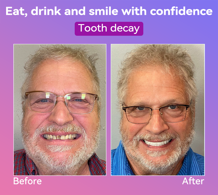 𝐉𝐚𝐬𝐬𝐞𝐞𝐦®🍎𝐍𝐞𝐱𝐭-𝐆𝐞𝐧 𝐂𝐨𝐦𝐟𝐨𝐫𝐭 𝐃𝐞𝐧𝐭𝐮𝐫𝐞(🦷𝐋𝐢𝐦𝐢𝐭𝐞𝐝 𝐭𝐢𝐦𝐞 𝐝𝐢𝐬𝐜𝐨𝐮𝐧𝐭 𝐋𝐚𝐬𝐭 𝟑𝟎 𝐦𝐢𝐧𝐮𝐭𝐞𝐬🦷)