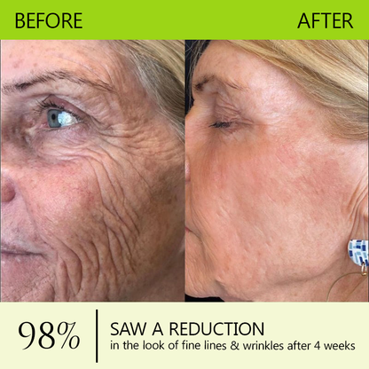 𝑶𝒇𝒇𝒊𝒄𝒊𝒂𝒍 𝑺𝒕𝒐𝒓𝒆💖 |Regain youthful skin nown 💫STDEI® BOTOX & VITA A RETINOL SHOT Wrinkle Lift Tightening Cream