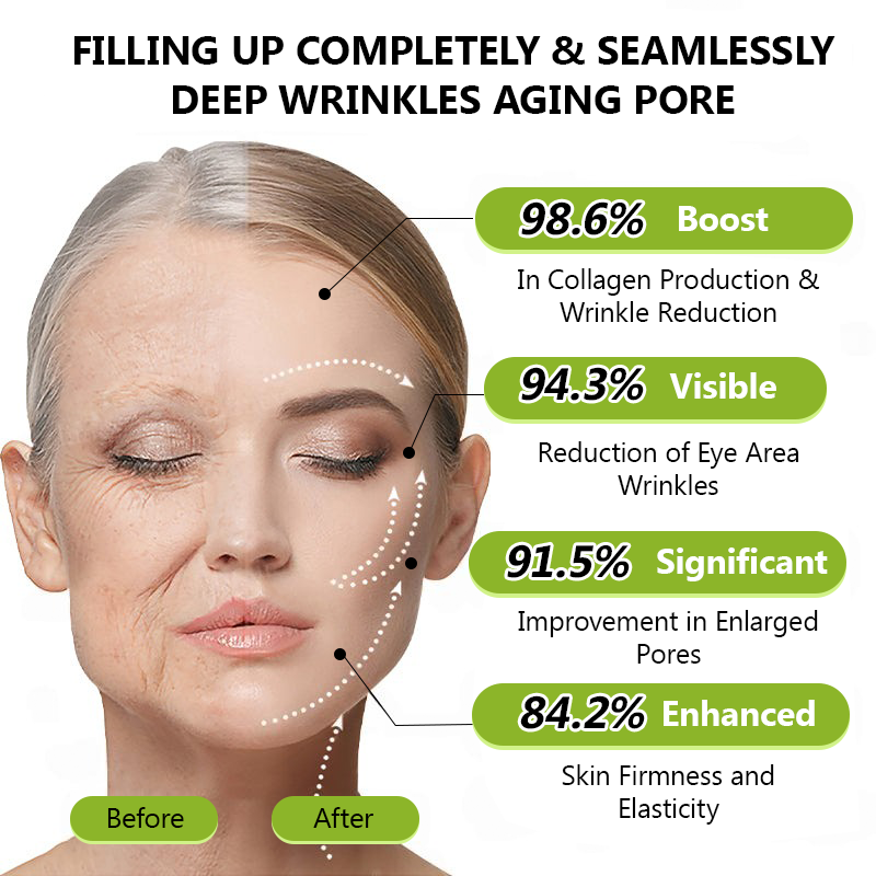 𝑶𝒇𝒇𝒊𝒄𝒊𝒂𝒍 𝑺𝒕𝒐𝒓𝒆💖 |Regain youthful skin nown 💫STDEI® BOTOX & VITA A RETINOL SHOT Wrinkle Lift Tightening Cream