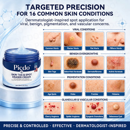 🍀𝐏𝐢𝐜𝐝𝐨® 7-𝐃𝐚𝐲 𝐒𝐤𝐢𝐧 𝐓𝐚𝐠 & 𝐒𝐩𝐨𝐭 𝐄𝐫𝐚𝐬𝐞𝐫 𝐂𝐫𝐞𝐚𝐦🩵 (Zero Pain, Zero 𝐒𝐜𝐚𝐫𝐬 Formula) 💪