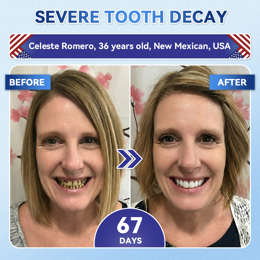 👩‍⚕️🎁 𝐆𝐥𝐢𝐦𝐦𝐞𝐫𝐥𝐲® 𝐓𝐢𝐝𝐞𝐠𝐥𝐮𝐬𝐢𝐛 𝐓𝐨𝐨𝐭𝐡 & 𝐆𝐮𝐦 𝐑𝐞𝐩𝐚𝐢𝐫 𝐌𝐢𝐜𝐫𝐨𝐧𝐞𝐞𝐝𝐥𝐞 𝐏𝐚𝐭𝐜𝐡  | 𝐀𝐝𝐯𝐚𝐧𝐜𝐞𝐝 𝐒𝐭𝐞𝐦-𝐂𝐞𝐥𝐥 𝐀𝐜𝐭𝐢𝐯𝐚𝐭𝐢𝐨𝐧 𝐓𝐞𝐞𝐭𝐡 𝐒𝐭𝐫𝐢𝐩𝐬(🦷𝐑𝐞𝐛𝐮𝐢𝐥𝐝 𝐄𝐧𝐚𝐦𝐞𝐥 & 𝐃𝐞𝐧𝐭𝐢𝐧 • 𝐒𝐭𝐫𝐞𝐧𝐠𝐭𝐡𝐞𝐧 𝐆𝐮𝐦𝐬 • 𝐄𝐫𝐚𝐝𝐢𝐜𝐚𝐭𝐞 𝐓𝐚𝐫𝐭𝐚𝐫 & 𝐎𝐝𝐨𝐫 • 𝐒𝐭𝐨𝐩 𝐓𝐨𝐨𝐭𝐡 𝐒𝐞𝐧𝐬𝐢𝐭𝐢𝐯𝐢𝐭𝐲)