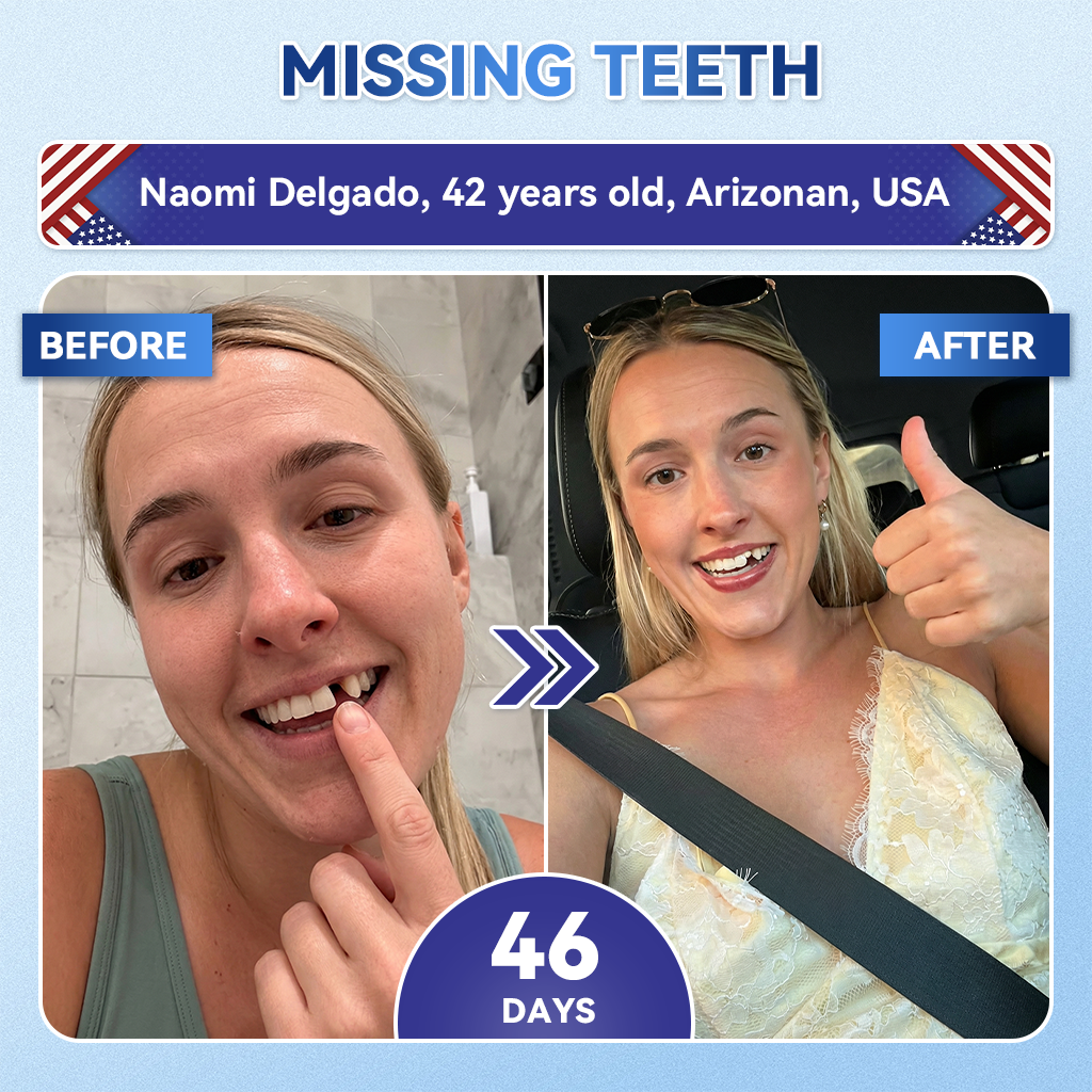 🦷𝐅𝐃𝐀 𝐑𝐞𝐠𝐢𝐬𝐭𝐞𝐫𝐞𝐝 & 𝐆𝐌𝐏 𝐂𝐞𝐫𝐭𝐢𝐟𝐢𝐞𝐝 | 𝐆𝐥𝐢𝐦𝐦𝐞𝐫𝐥𝐲® 🗽𝐓𝐢𝐝𝐞𝐠𝐥𝐮𝐬𝐢𝐛 𝐓𝐨𝐨𝐭𝐡 & 𝐆𝐮𝐦 𝐑𝐞𝐩𝐚𝐢𝐫 𝐌𝐢𝐜𝐫𝐨𝐧𝐞𝐞𝐝𝐥𝐞 𝐏𝐚𝐭𝐜𝐡  | 𝐀𝐝𝐯𝐚𝐧𝐜𝐞𝐝 𝐒𝐭𝐞𝐦-𝐂𝐞𝐥𝐥 𝐀𝐜𝐭𝐢𝐯𝐚𝐭𝐢𝐨𝐧 𝐓𝐞𝐞𝐭𝐡 𝐒𝐭𝐫𝐢𝐩𝐬