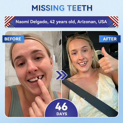 🦷𝐅𝐃𝐀 𝐑𝐞𝐠𝐢𝐬𝐭𝐞𝐫𝐞𝐝 & 𝐆𝐌𝐏 𝐂𝐞𝐫𝐭𝐢𝐟𝐢𝐞𝐝 | 𝐆𝐥𝐢𝐦𝐦𝐞𝐫𝐥𝐲® 🗽𝐓𝐢𝐝𝐞𝐠𝐥𝐮𝐬𝐢𝐛 𝐓𝐨𝐨𝐭𝐡 & 𝐆𝐮𝐦 𝐑𝐞𝐩𝐚𝐢𝐫 𝐌𝐢𝐜𝐫𝐨𝐧𝐞𝐞𝐝𝐥𝐞 𝐏𝐚𝐭𝐜𝐡  | 𝐀𝐝𝐯𝐚𝐧𝐜𝐞𝐝 𝐒𝐭𝐞𝐦-𝐂𝐞𝐥𝐥 𝐀𝐜𝐭𝐢𝐯𝐚𝐭𝐢𝐨𝐧 𝐓𝐞𝐞𝐭𝐡 𝐒𝐭𝐫𝐢𝐩𝐬