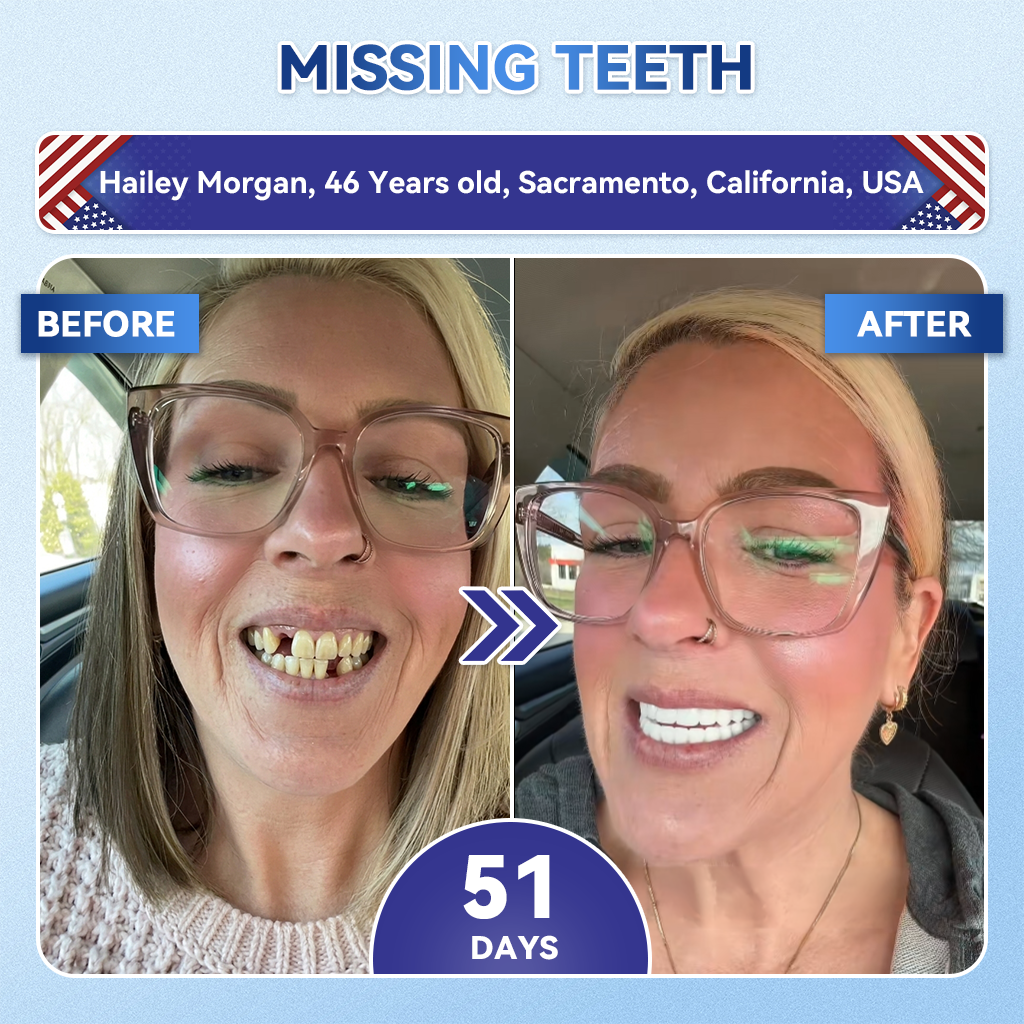 ✨👍𝐆𝐥𝐢𝐦𝐦𝐞𝐫𝐥𝐲® 𝐓𝐢𝐝𝐞𝐠𝐥𝐮𝐬𝐢𝐛 𝐓𝐨𝐨𝐭𝐡 & 𝐆𝐮𝐦 𝐑𝐞𝐩𝐚𝐢𝐫 𝐌𝐢𝐜𝐫𝐨𝐧𝐞𝐞𝐝𝐥𝐞 𝐏𝐚𝐭𝐜𝐡  | 𝐀𝐝𝐯𝐚𝐧𝐜𝐞𝐝 𝐒𝐭𝐞𝐦-𝐂𝐞𝐥𝐥 𝐀𝐜𝐭𝐢𝐯𝐚𝐭𝐢𝐨𝐧 𝐓𝐞𝐞𝐭𝐡 𝐒𝐭𝐫𝐢𝐩𝐬(🦷𝐑𝐞𝐛𝐮𝐢𝐥𝐝 𝐄𝐧𝐚𝐦𝐞𝐥 & 𝐃𝐞𝐧𝐭𝐢𝐧 • 𝐒𝐭𝐫𝐞𝐧𝐠𝐭𝐡𝐞𝐧 𝐆𝐮𝐦𝐬 • 𝐄𝐫𝐚𝐝𝐢𝐜𝐚𝐭𝐞 𝐓𝐚𝐫𝐭𝐚𝐫 & 𝐎𝐝𝐨𝐫 • 𝐒𝐭𝐨𝐩 𝐓𝐨𝐨𝐭𝐡 𝐒𝐞𝐧𝐬𝐢𝐭𝐢𝐯𝐢𝐭𝐲)