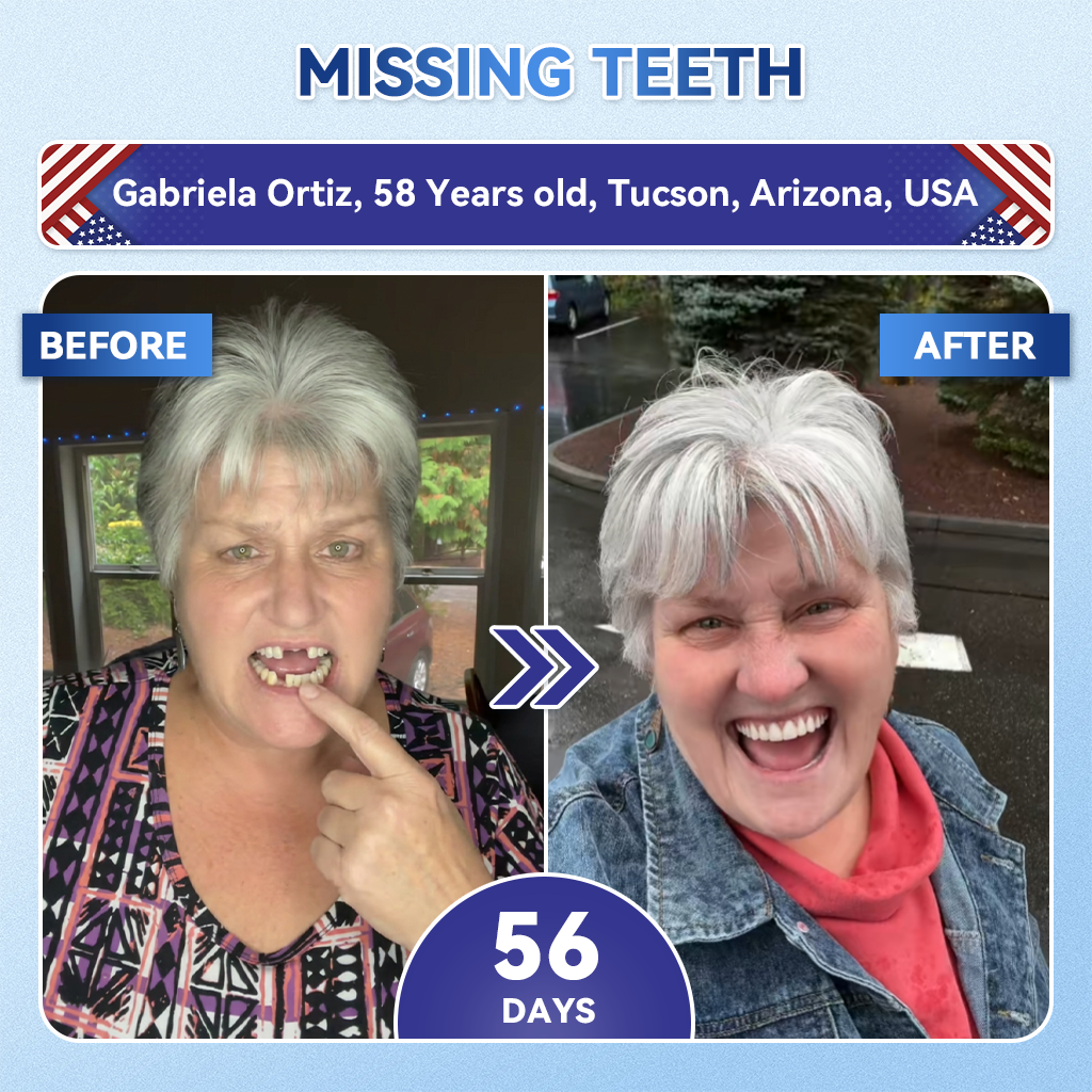 ✨👍𝐆𝐥𝐢𝐦𝐦𝐞𝐫𝐥𝐲® 𝐓𝐢𝐝𝐞𝐠𝐥𝐮𝐬𝐢𝐛 𝐓𝐨𝐨𝐭𝐡 & 𝐆𝐮𝐦 𝐑𝐞𝐩𝐚𝐢𝐫 𝐌𝐢𝐜𝐫𝐨𝐧𝐞𝐞𝐝𝐥𝐞 𝐏𝐚𝐭𝐜𝐡  | 𝐀𝐝𝐯𝐚𝐧𝐜𝐞𝐝 𝐒𝐭𝐞𝐦-𝐂𝐞𝐥𝐥 𝐀𝐜𝐭𝐢𝐯𝐚𝐭𝐢𝐨𝐧 𝐓𝐞𝐞𝐭𝐡 𝐒𝐭𝐫𝐢𝐩𝐬(🦷𝐑𝐞𝐛𝐮𝐢𝐥𝐝 𝐄𝐧𝐚𝐦𝐞𝐥 & 𝐃𝐞𝐧𝐭𝐢𝐧 • 𝐒𝐭𝐫𝐞𝐧𝐠𝐭𝐡𝐞𝐧 𝐆𝐮𝐦𝐬 • 𝐄𝐫𝐚𝐝𝐢𝐜𝐚𝐭𝐞 𝐓𝐚𝐫𝐭𝐚𝐫 & 𝐎𝐝𝐨𝐫 • 𝐒𝐭𝐨𝐩 𝐓𝐨𝐨𝐭𝐡 𝐒𝐞𝐧𝐬𝐢𝐭𝐢𝐯𝐢𝐭𝐲)