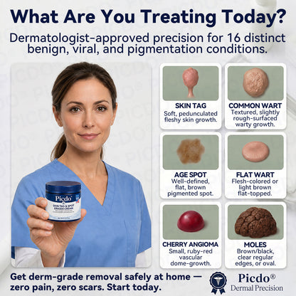 🍀𝐏𝐢𝐜𝐝𝐨® 7-𝐃𝐚𝐲 𝐒𝐤𝐢𝐧 𝐓𝐚𝐠 & 𝐒𝐩𝐨𝐭 𝐄𝐫𝐚𝐬𝐞𝐫 𝐂𝐫𝐞𝐚𝐦🩵 (Zero Pain, Zero 𝐒𝐜𝐚𝐫𝐬 Formula) 💪