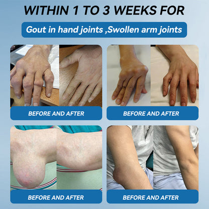 𝐎𝐟𝐟𝐢𝐜𝐢𝐚𝐥 𝐬𝐭𝐨𝐫𝐞 👩‍⚕️🎉|𝑷𝐢𝐜𝐝o® 𝑩𝐏𝐂-𝟏𝟓𝟕 𝐉𝐨𝐢𝐧𝐭 𝐇𝐞𝐚𝐥𝐢𝐧𝐠 𝐂𝐫𝐞𝐚𝐦🦴𝐓𝐫𝐞𝐚𝐭𝐬 𝐀𝐫𝐭𝐡𝐫𝐢𝐭𝐢𝐬, 𝐍𝐞𝐮𝐫𝐨𝐩𝐚𝐭𝐡𝐲, 𝐑𝐡𝐞𝐮𝐦𝐚𝐭𝐢𝐬𝐦, 𝐒𝐩𝐨𝐫𝐭𝐬 𝐈𝐧𝐣𝐮𝐫𝐢𝐞𝐬 & 𝐌𝐨𝐫𝐞 👍