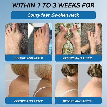 𝐎𝐟𝐟𝐢𝐜𝐢𝐚𝐥 𝐬𝐭𝐨𝐫𝐞 👩‍⚕️🎉|𝑷𝐢𝐜𝐝o® 𝑩𝐏𝐂-𝟏𝟓𝟕 𝐉𝐨𝐢𝐧𝐭 𝐇𝐞𝐚𝐥𝐢𝐧𝐠 𝐂𝐫𝐞𝐚𝐦🦴𝐓𝐫𝐞𝐚𝐭𝐬 𝐀𝐫𝐭𝐡𝐫𝐢𝐭𝐢𝐬, 𝐍𝐞𝐮𝐫𝐨𝐩𝐚𝐭𝐡𝐲, 𝐑𝐡𝐞𝐮𝐦𝐚𝐭𝐢𝐬𝐦, 𝐒𝐩𝐨𝐫𝐭𝐬 𝐈𝐧𝐣𝐮𝐫𝐢𝐞𝐬 & 𝐌𝐨𝐫𝐞 👍