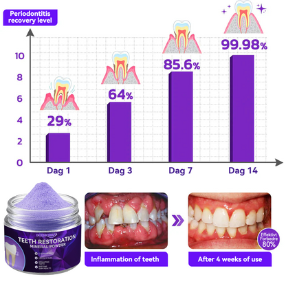 𝐃𝐨𝐫𝐦𝐨𝐫𝐧𝐚® 🍀Teeth Restoration Mineral Powder🦷(🎁Flash Sale - Don’t Miss Out)