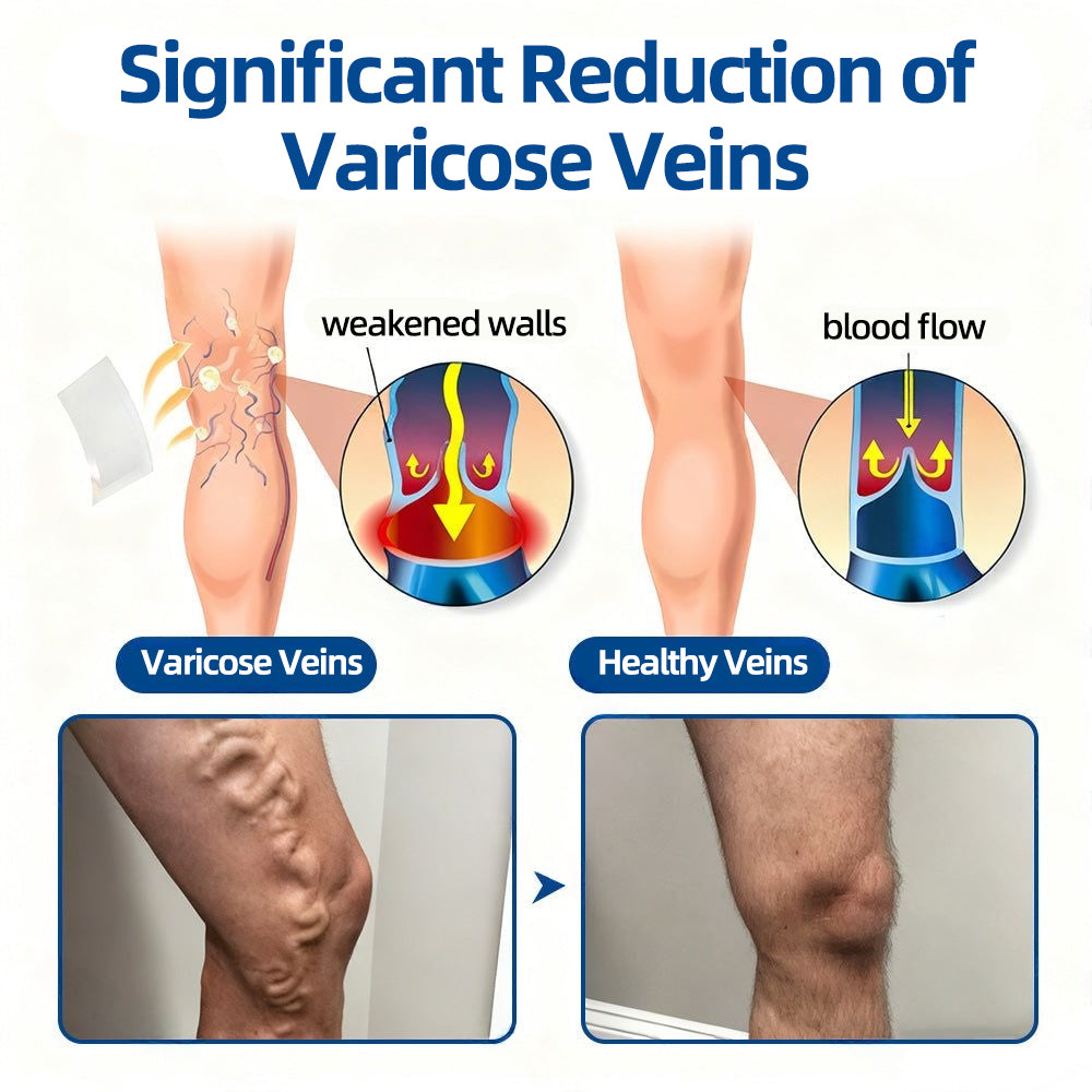 👩‍⚕️🎁 𝐅𝐥𝐨𝐫𝐢𝐬𝐦𝐚® ✅ 𝐕𝐞𝐢𝐧𝐓𝐚𝐫𝐠𝐞𝐭 𝐌𝐢𝐜𝐫𝐨𝐧𝐞𝐞𝐝𝐥𝐞 𝐏𝐚𝐭𝐜𝐡⚡Instant Relief, Long-Term Results