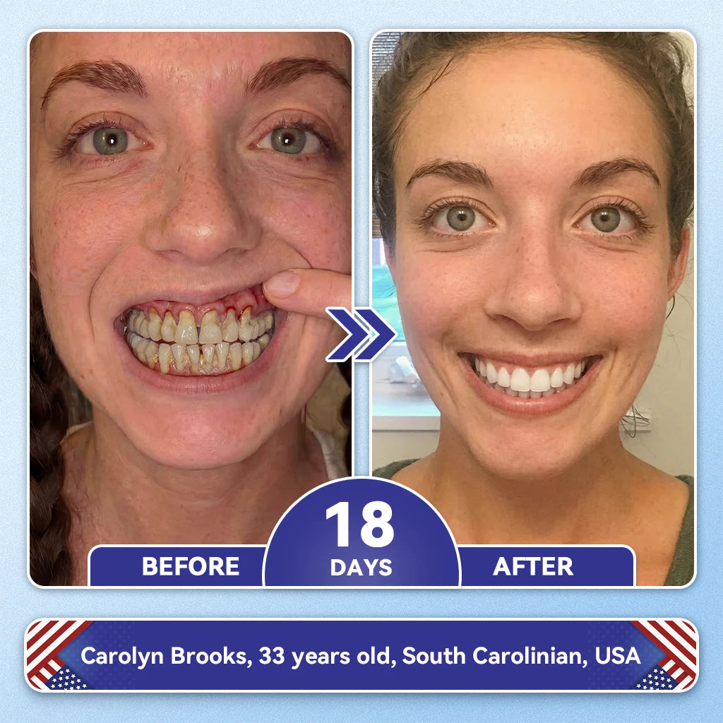 🦷𝐅𝐃𝐀 𝐑𝐞𝐠𝐢𝐬𝐭𝐞𝐫𝐞𝐝 & 𝐆𝐌𝐏 𝐂𝐞𝐫𝐭𝐢𝐟𝐢𝐞𝐝 | 𝐆𝐥𝐢𝐦𝐦𝐞𝐫𝐥𝐲® 🗽𝐓𝐢𝐝𝐞𝐠𝐥𝐮𝐬𝐢𝐛 𝐓𝐨𝐨𝐭𝐡 & 𝐆𝐮𝐦 𝐑𝐞𝐩𝐚𝐢𝐫 𝐌𝐢𝐜𝐫𝐨𝐧𝐞𝐞𝐝𝐥𝐞 𝐏𝐚𝐭𝐜𝐡  | 𝐀𝐝𝐯𝐚𝐧𝐜𝐞𝐝 𝐒𝐭𝐞𝐦-𝐂𝐞𝐥𝐥 𝐀𝐜𝐭𝐢𝐯𝐚𝐭𝐢𝐨𝐧 𝐓𝐞𝐞𝐭𝐡 𝐒𝐭𝐫𝐢𝐩𝐬