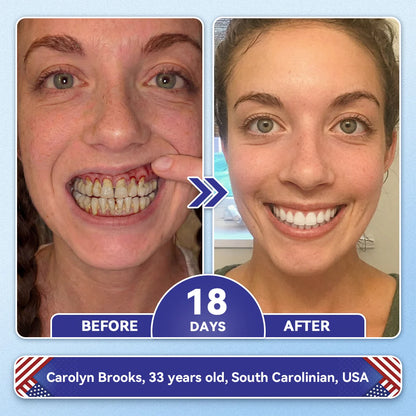 🦷𝐅𝐃𝐀 𝐑𝐞𝐠𝐢𝐬𝐭𝐞𝐫𝐞𝐝 & 𝐆𝐌𝐏 𝐂𝐞𝐫𝐭𝐢𝐟𝐢𝐞𝐝 | 𝐆𝐥𝐢𝐦𝐦𝐞𝐫𝐥𝐲® 🗽𝐓𝐢𝐝𝐞𝐠𝐥𝐮𝐬𝐢𝐛 𝐓𝐨𝐨𝐭𝐡 & 𝐆𝐮𝐦 𝐑𝐞𝐩𝐚𝐢𝐫 𝐌𝐢𝐜𝐫𝐨𝐧𝐞𝐞𝐝𝐥𝐞 𝐏𝐚𝐭𝐜𝐡  | 𝐀𝐝𝐯𝐚𝐧𝐜𝐞𝐝 𝐒𝐭𝐞𝐦-𝐂𝐞𝐥𝐥 𝐀𝐜𝐭𝐢𝐯𝐚𝐭𝐢𝐨𝐧 𝐓𝐞𝐞𝐭𝐡 𝐒𝐭𝐫𝐢𝐩𝐬