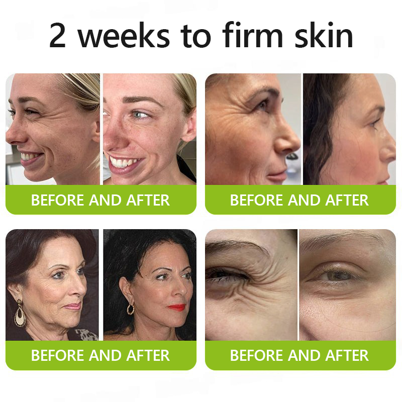 𝑶𝒇𝒇𝒊𝒄𝒊𝒂𝒍 𝑺𝒕𝒐𝒓𝒆💖 |Regain youthful skin nown 💫STDEI® BOTOX & VITA A RETINOL SHOT Wrinkle Lift Tightening Cream