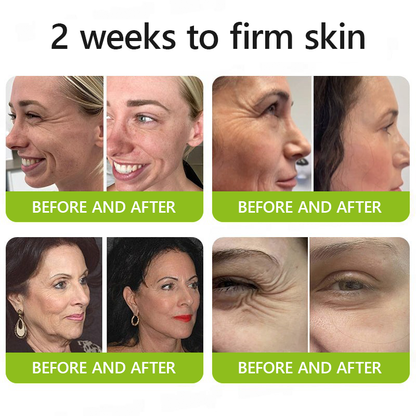 𝑶𝒇𝒇𝒊𝒄𝒊𝒂𝒍 𝑺𝒕𝒐𝒓𝒆💖 |Regain youthful skin nown 💫STDEI® BOTOX & VITA A RETINOL SHOT Wrinkle Lift Tightening Cream