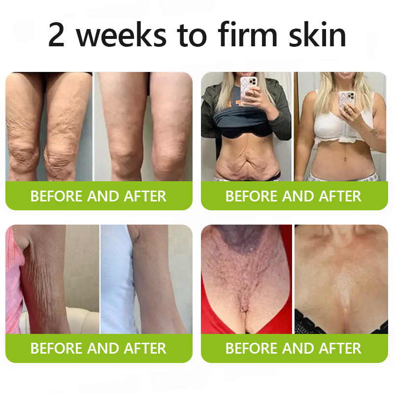 𝑶𝒇𝒇𝒊𝒄𝒊𝒂𝒍 𝑺𝒕𝒐𝒓𝒆💖 |Regain youthful skin nown 💫STDEI® BOTOX & VITA A RETINOL SHOT Wrinkle Lift Tightening Cream