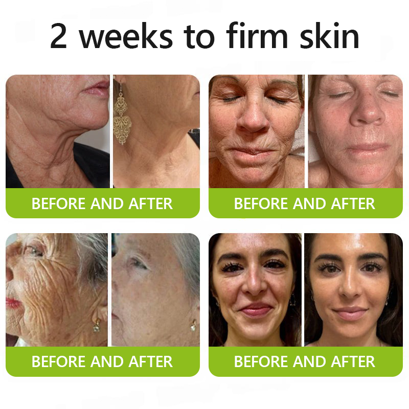𝑶𝒇𝒇𝒊𝒄𝒊𝒂𝒍 𝑺𝒕𝒐𝒓𝒆💖 |Regain youthful skin nown 💫STDEI® BOTOX & VITA A RETINOL SHOT Wrinkle Lift Tightening Cream