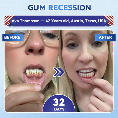 ✨👍𝐆𝐥𝐢𝐦𝐦𝐞𝐫𝐥𝐲® 𝐓𝐢𝐝𝐞𝐠𝐥𝐮𝐬𝐢𝐛 𝐓𝐨𝐨𝐭𝐡 & 𝐆𝐮𝐦 𝐑𝐞𝐩𝐚𝐢𝐫 𝐌𝐢𝐜𝐫𝐨𝐧𝐞𝐞𝐝𝐥𝐞 𝐏𝐚𝐭𝐜𝐡  | 𝐀𝐝𝐯𝐚𝐧𝐜𝐞𝐝 𝐒𝐭𝐞𝐦-𝐂𝐞𝐥𝐥 𝐀𝐜𝐭𝐢𝐯𝐚𝐭𝐢𝐨𝐧 𝐓𝐞𝐞𝐭𝐡 𝐒𝐭𝐫𝐢𝐩𝐬(🦷𝐑𝐞𝐛𝐮𝐢𝐥𝐝 𝐄𝐧𝐚𝐦𝐞𝐥 & 𝐃𝐞𝐧𝐭𝐢𝐧 • 𝐒𝐭𝐫𝐞𝐧𝐠𝐭𝐡𝐞𝐧 𝐆𝐮𝐦𝐬 • 𝐄𝐫𝐚𝐝𝐢𝐜𝐚𝐭𝐞 𝐓𝐚𝐫𝐭𝐚𝐫 & 𝐎𝐝𝐨𝐫 • 𝐒𝐭𝐨𝐩 𝐓𝐨𝐨𝐭𝐡 𝐒𝐞𝐧𝐬𝐢𝐭𝐢𝐯𝐢𝐭𝐲)